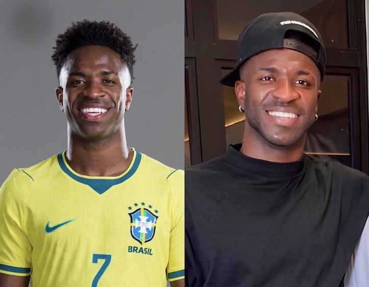 Vinicius-jr-chirugie-faciale